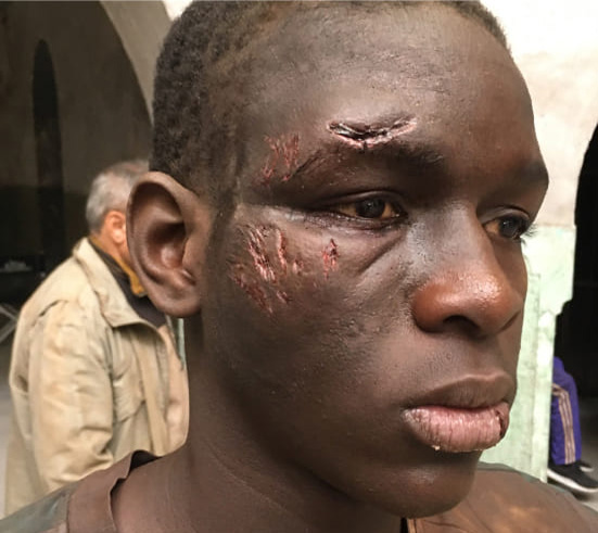 special effects wounds for the protagonist of the film 'Io Capitano' directed by Matteo Garrone